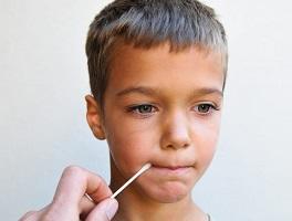 photo-of-boy-with-cotton-buds-on-lips.jpg