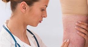 doctor-checking-varicose-veins.jpg