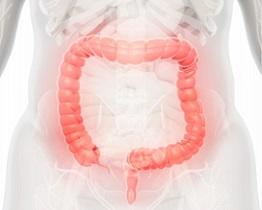 photo-of-human-colon.jpg