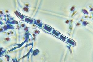 microscopic-image-of-dermatophytes.jpg