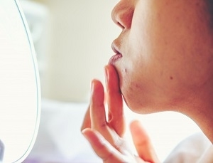 Close up Girl applying aloe gel to problematic skin with acne scars