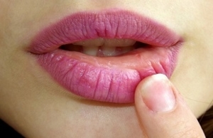 Photo of Closeup Lips